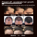 Anti Hair Loss Boosting Hair Growth Serum